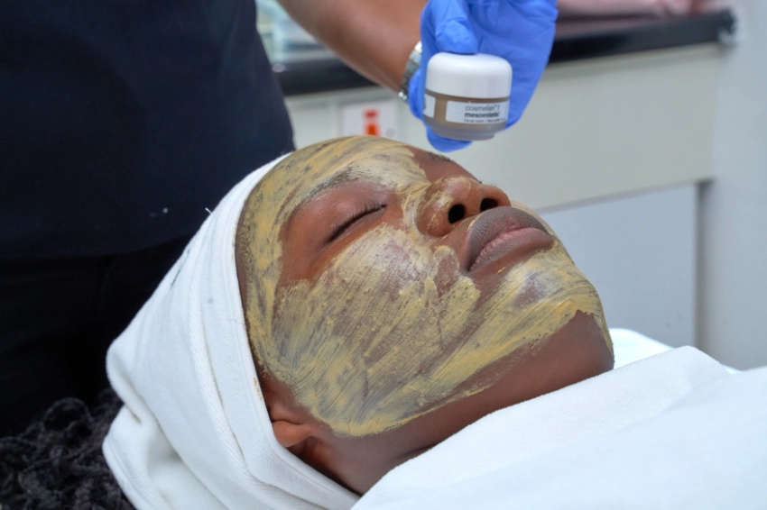 Deep Peels Treatment Service in Nairobi Kenya - Skin Reveal Aesthetics