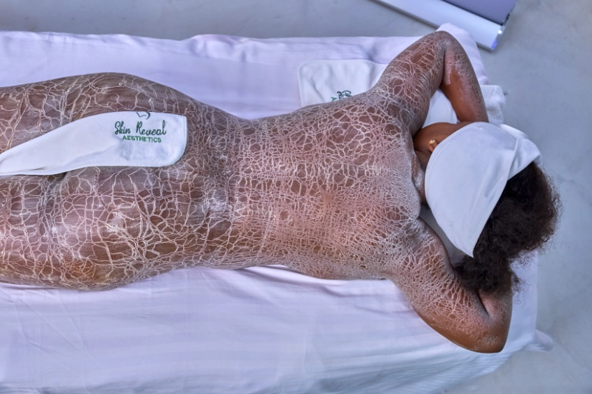 Body Enzyme Treatment Service in Nairobi Kenya - Skin Reveal Aesthetics